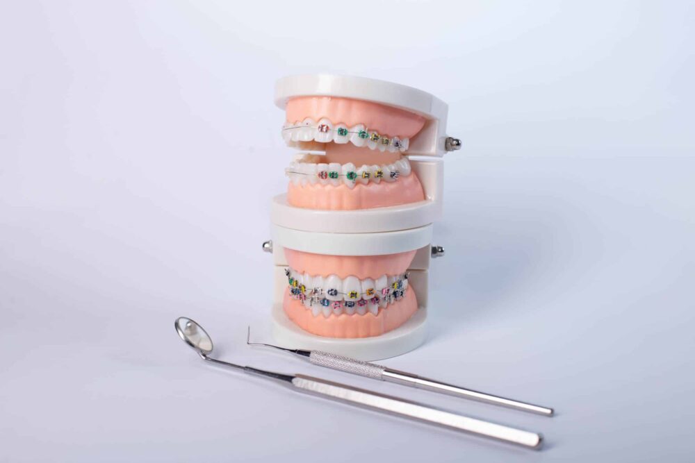Orthodontics Conroe